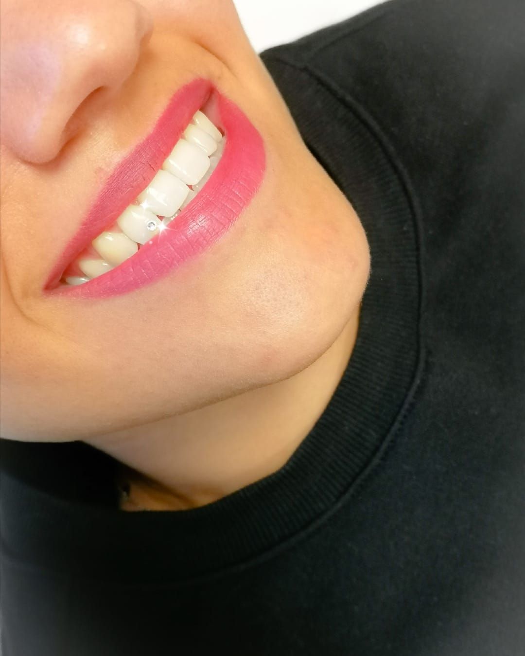 astrid studio bolzano piercing dentale bolzano